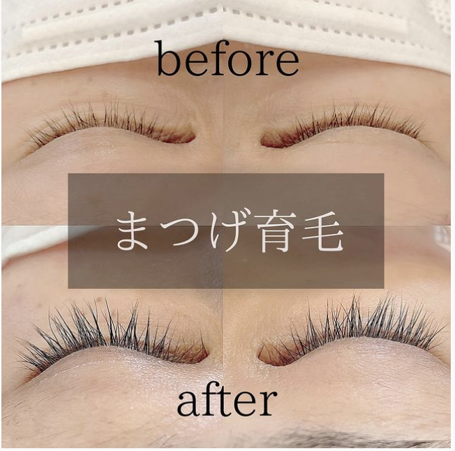 エステ ネイル 水戸 美容室 求人 マツエク ネイル 茨城県 クローバー 968 エステ ネイル 水戸 美容室 求人 マツエク ネイル 茨城県 クローバー 968